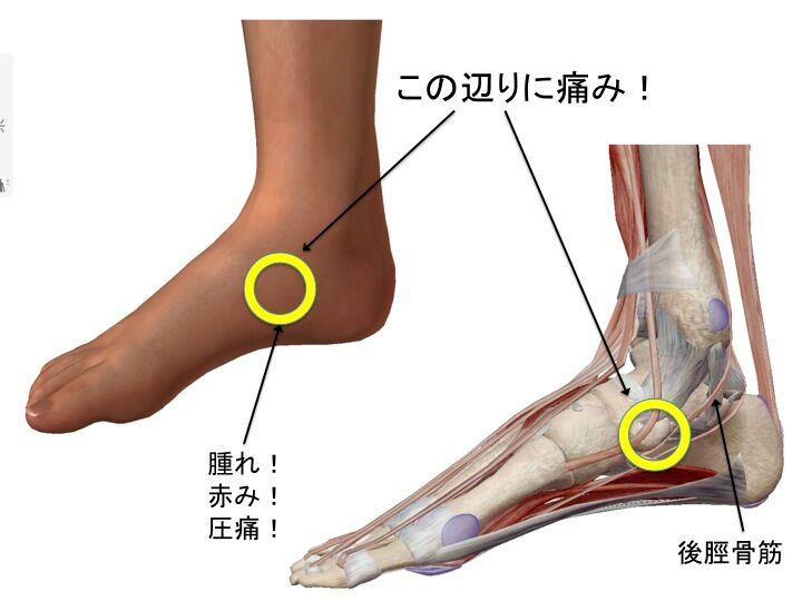 外頚骨　